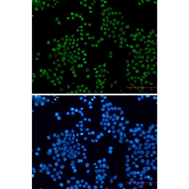 Acetyl-Histone H3 (Lys27) Rabbit mAb ABZ4314