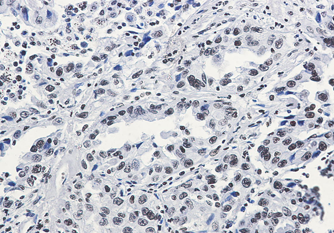Acetyl-Histone H3 (Lys27) Rabbit mAb ABZ4314