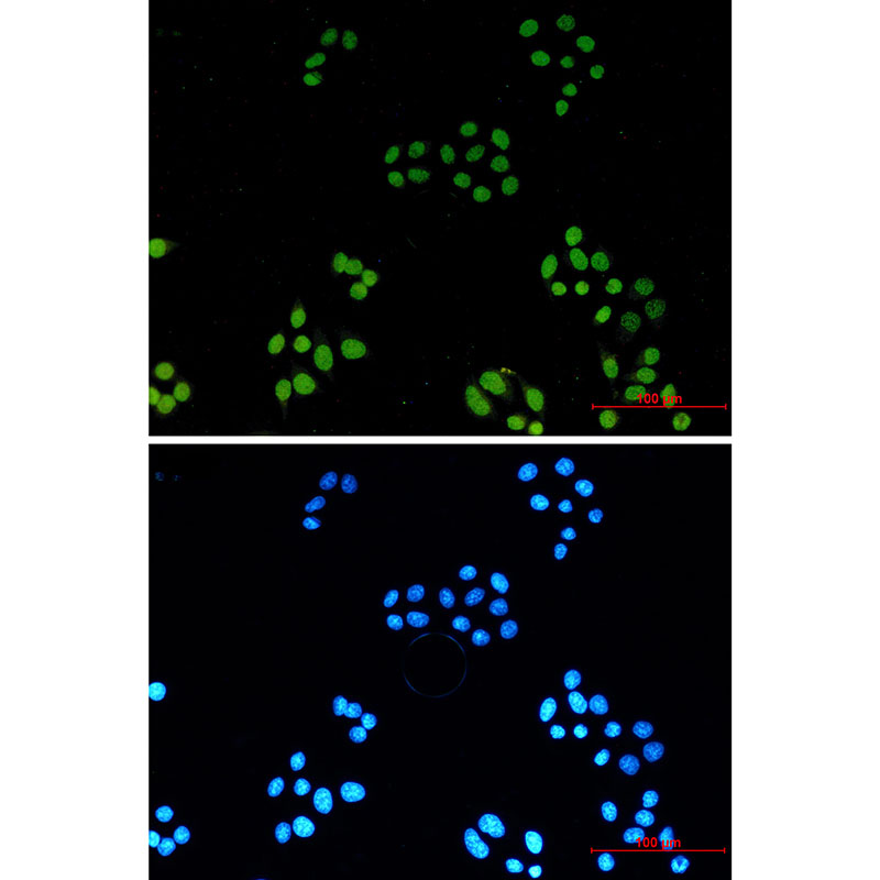 Acetyl-Histone H3 (Lys4) Rabbit mAb ABZ4316