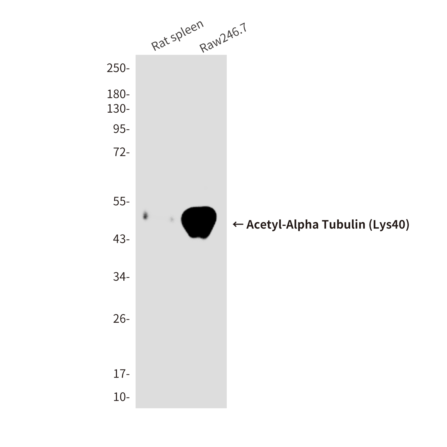 Acetyl-Alpha Tubulin (Lys40) (6B5) Mouse mAb ABZ4318