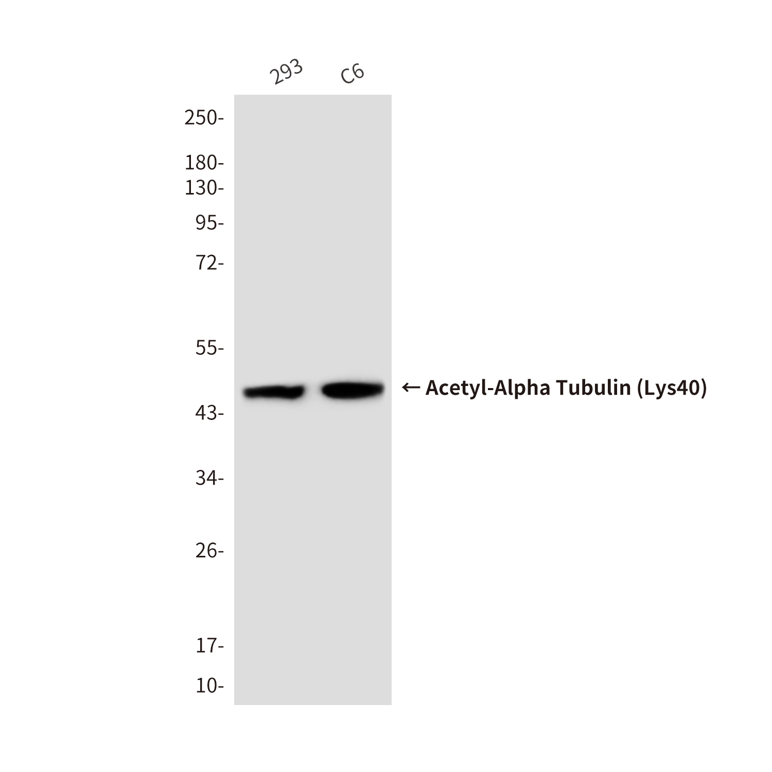 Acetyl-Alpha Tubulin (Lys40) (6B5) Mouse mAb ABZ4318