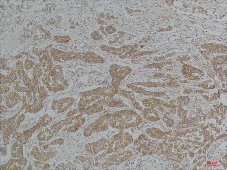 Acetyl-Alpha Tubulin (Lys40) (9B8) Mouse mAb ABZ4319