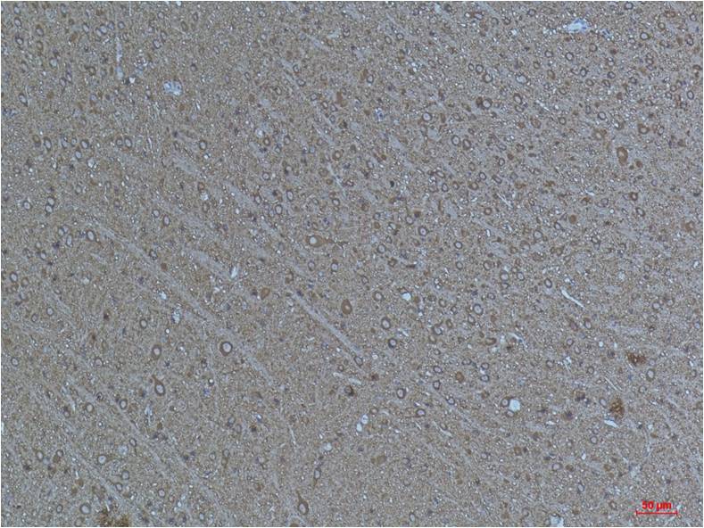 Acetyl-Alpha Tubulin (Lys40) (9B8) Mouse mAb ABZ4319