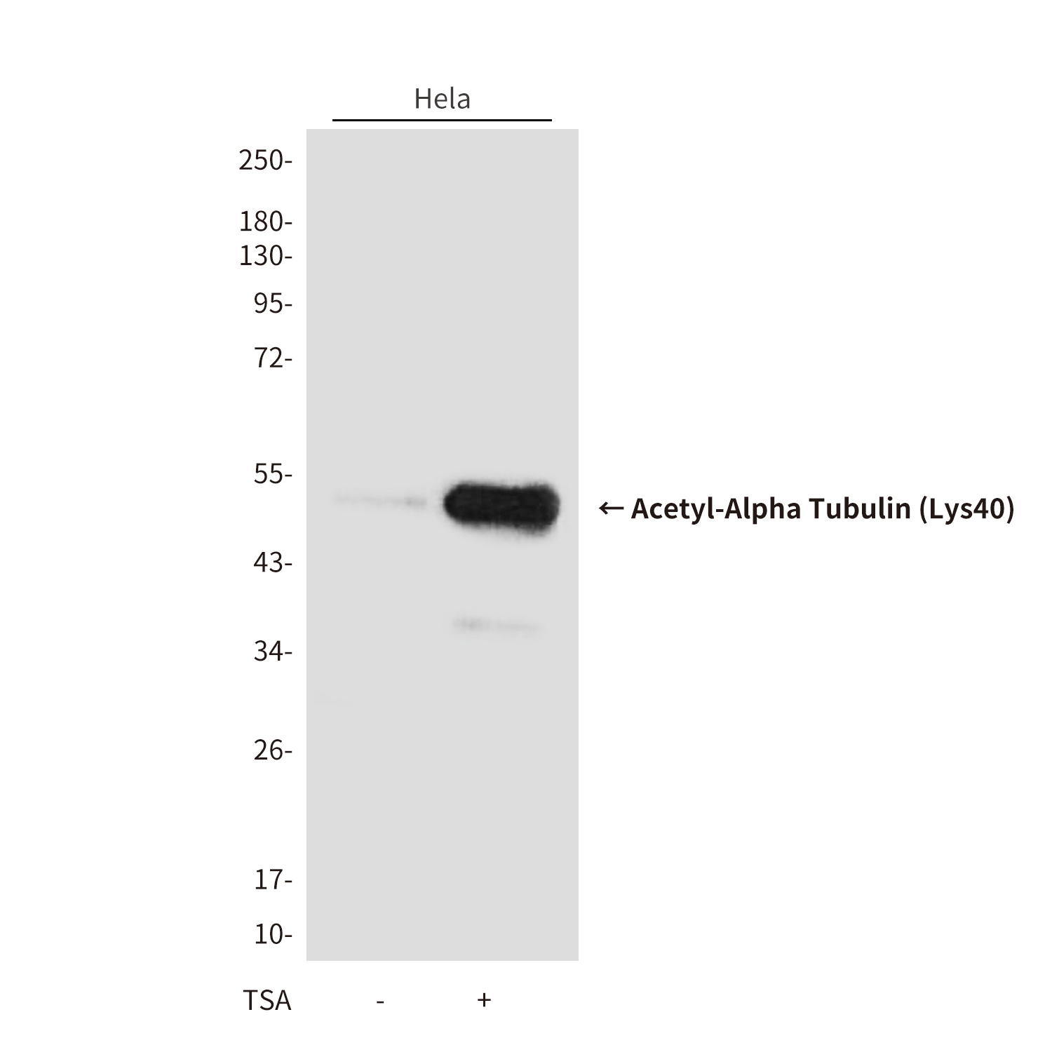 Acetyl-Alpha Tubulin (Lys40) (9B8) Mouse mAb ABZ4319