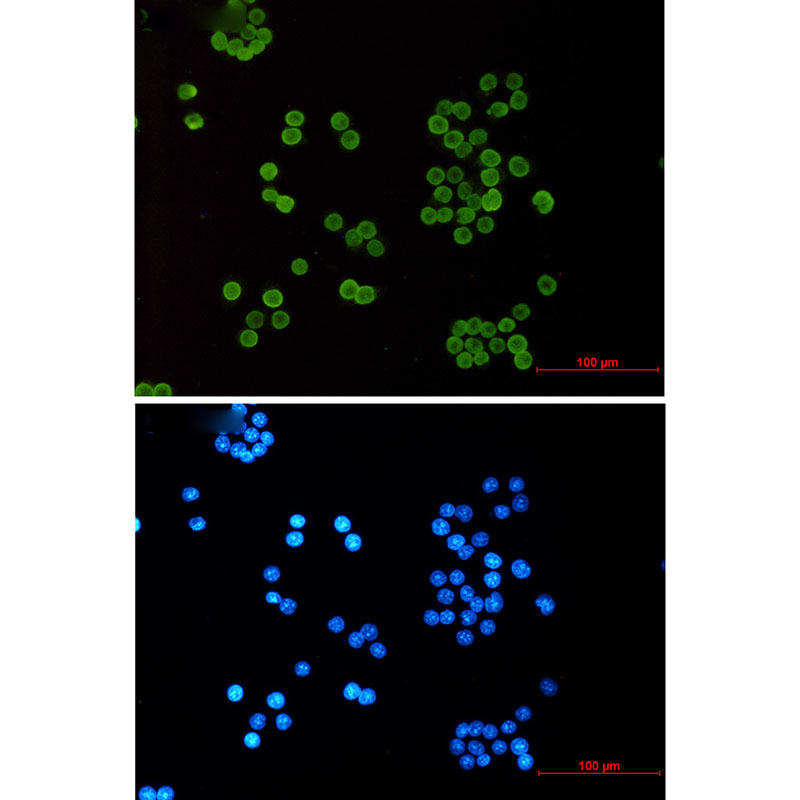 Acetyl-Histone H4 (Lys5) Rabbit mAb ABZ4320