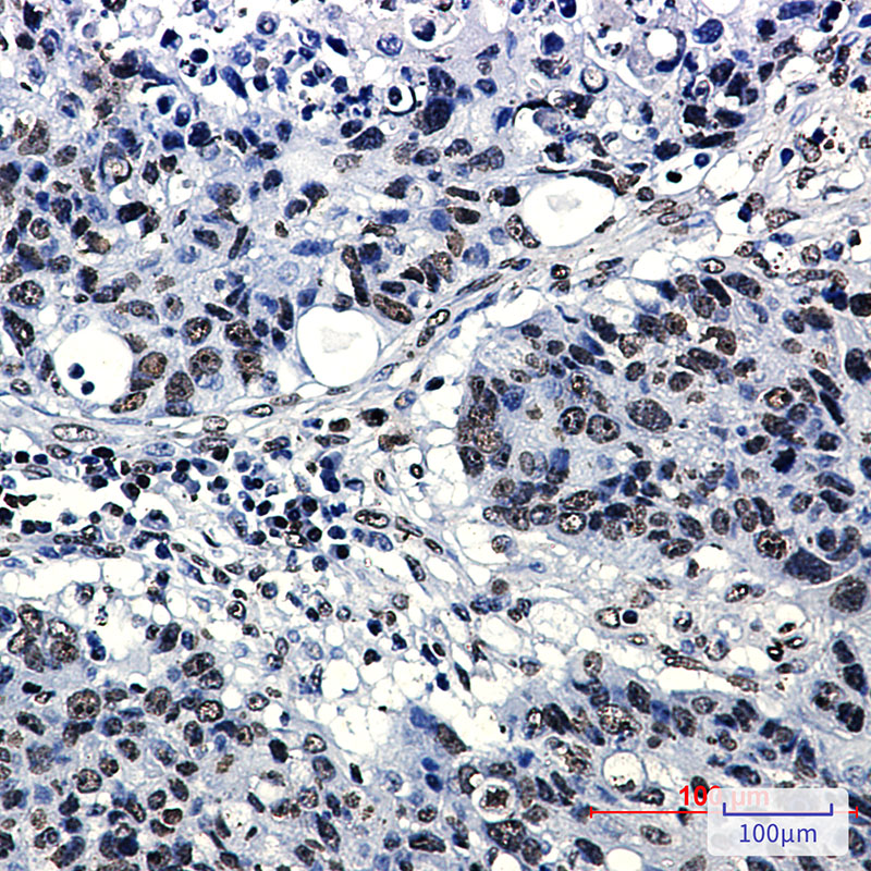 Acetyl-Histone H4 (Lys5) Rabbit mAb ABZ4320