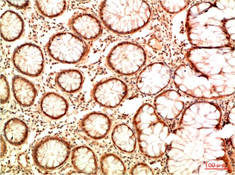 Acetyl-p53 (Lys382) (7E1) Mouse mAb ABZ4321