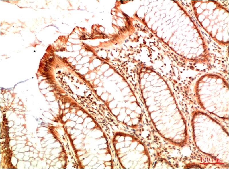Acetyl-p53 (Lys382) (7E1) Mouse mAb ABZ4321