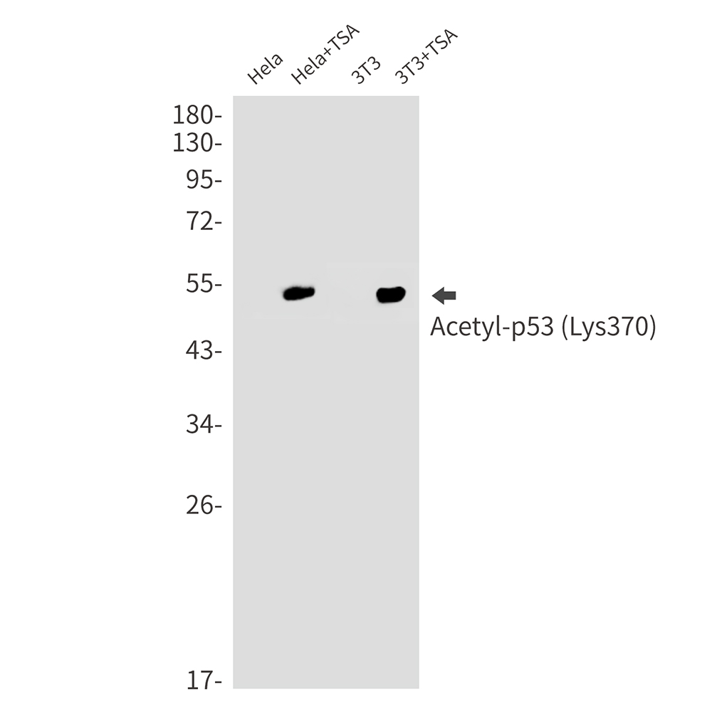 Acetyl-p53 (Lys370) Rabbit mAb ABZ4322