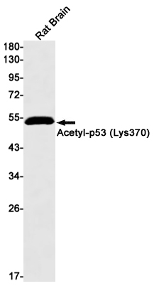 Acetyl-p53 (Lys370) Rabbit mAb ABZ4322
