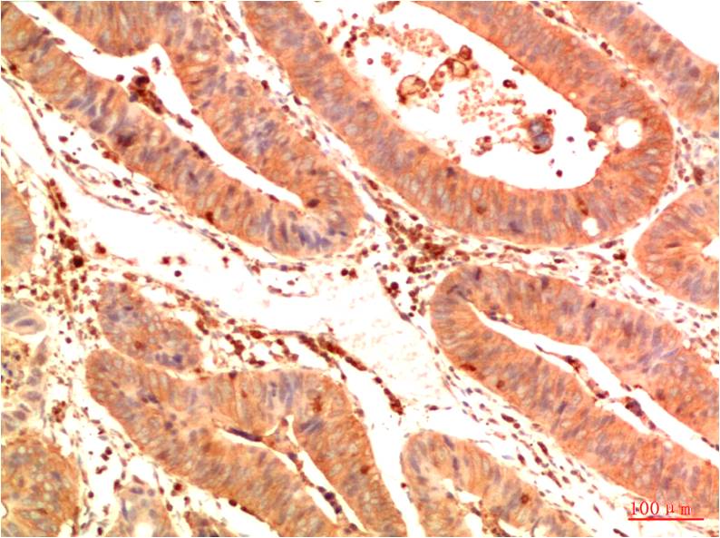 Acetyl-p53 (Lys382) (3E3) Mouse mAb ABZ4324
