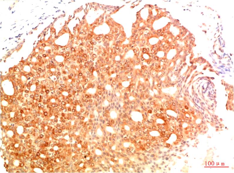 Acetyl-p53 (Lys382) (3E3) Mouse mAb ABZ4324