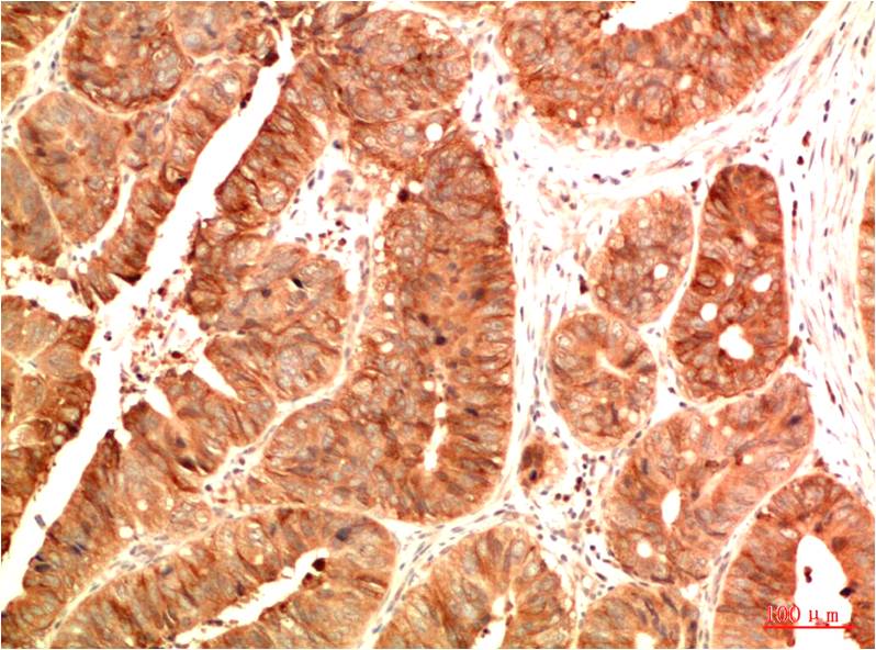 Acetyl-p53 (Lys382) (2G4) Mouse mAb ABZ4325