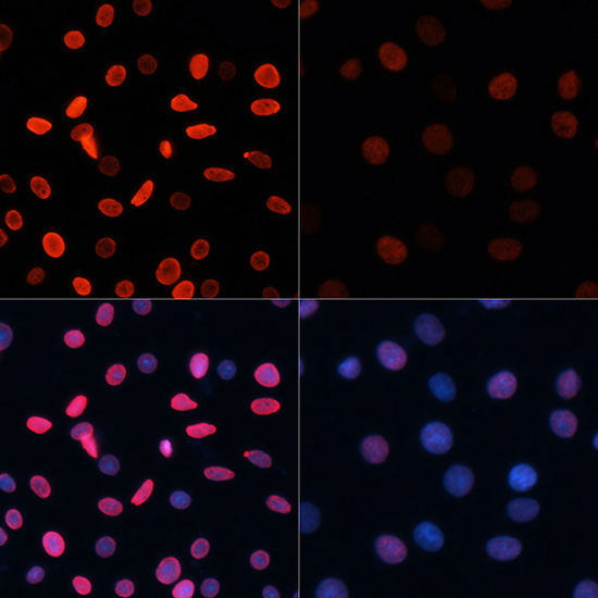 Acetyl-Histone H2B (Lys5) Rabbit pAb ABZ4327