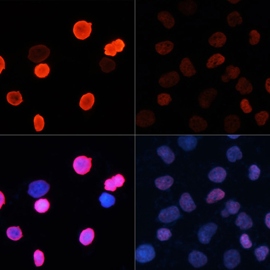Acetyl-Histone H2B (Lys5) Rabbit pAb ABZ4327