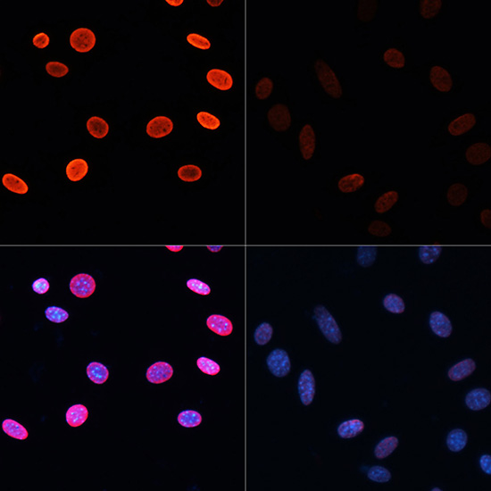 Acetyl-Histone H2B (Lys5) Rabbit pAb ABZ4327