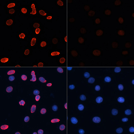 Acetyl-Histone H2B (Lys15) Rabbit pAb ABZ4328