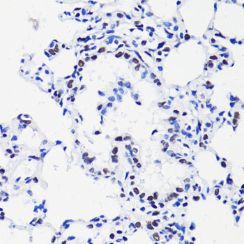 Acetyl-Histone H2B (Lys15) Rabbit pAb ABZ4328