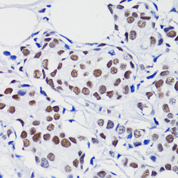 Acetyl-Histone H2B (Lys15) Rabbit pAb ABZ4328