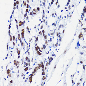 Acetyl-Histone H2B (Lys15) Rabbit pAb ABZ4328