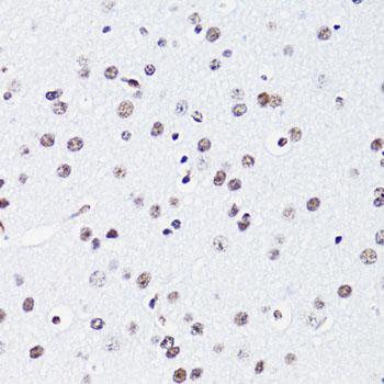 Acetyl-Histone H2B (Lys15) Rabbit pAb ABZ4328