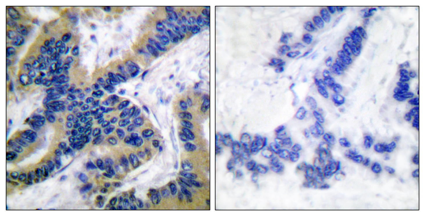 Cleaved-Caspase 6 p18 Rabbit pAb ABZ4330