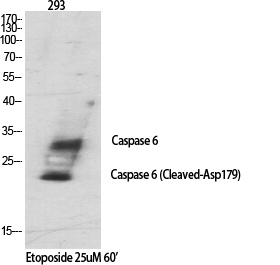 Cleaved-Caspase 6 p18 Rabbit pAb ABZ4330