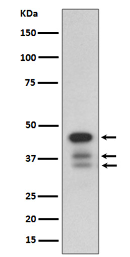Cleaved-Caspase 9 Rabbit mAb ABZ4331