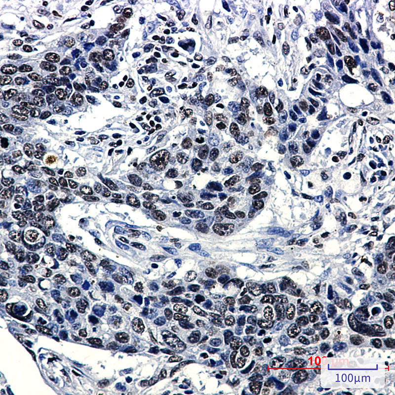 Hydroxyl-Histone H2A (Tyr39) Rabbit mAb ABZ4339