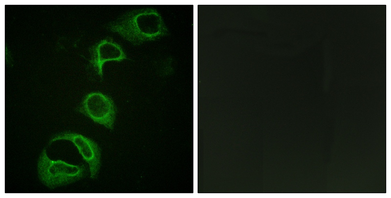 Phospho-ALK (Tyr1604) Rabbit pAb ABZ4342