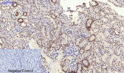 Phospho-PERK (Thr982) Rabbit pAb ABZ4345