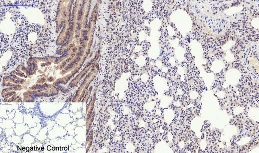 Phospho-PERK (Thr982) Rabbit pAb ABZ4345