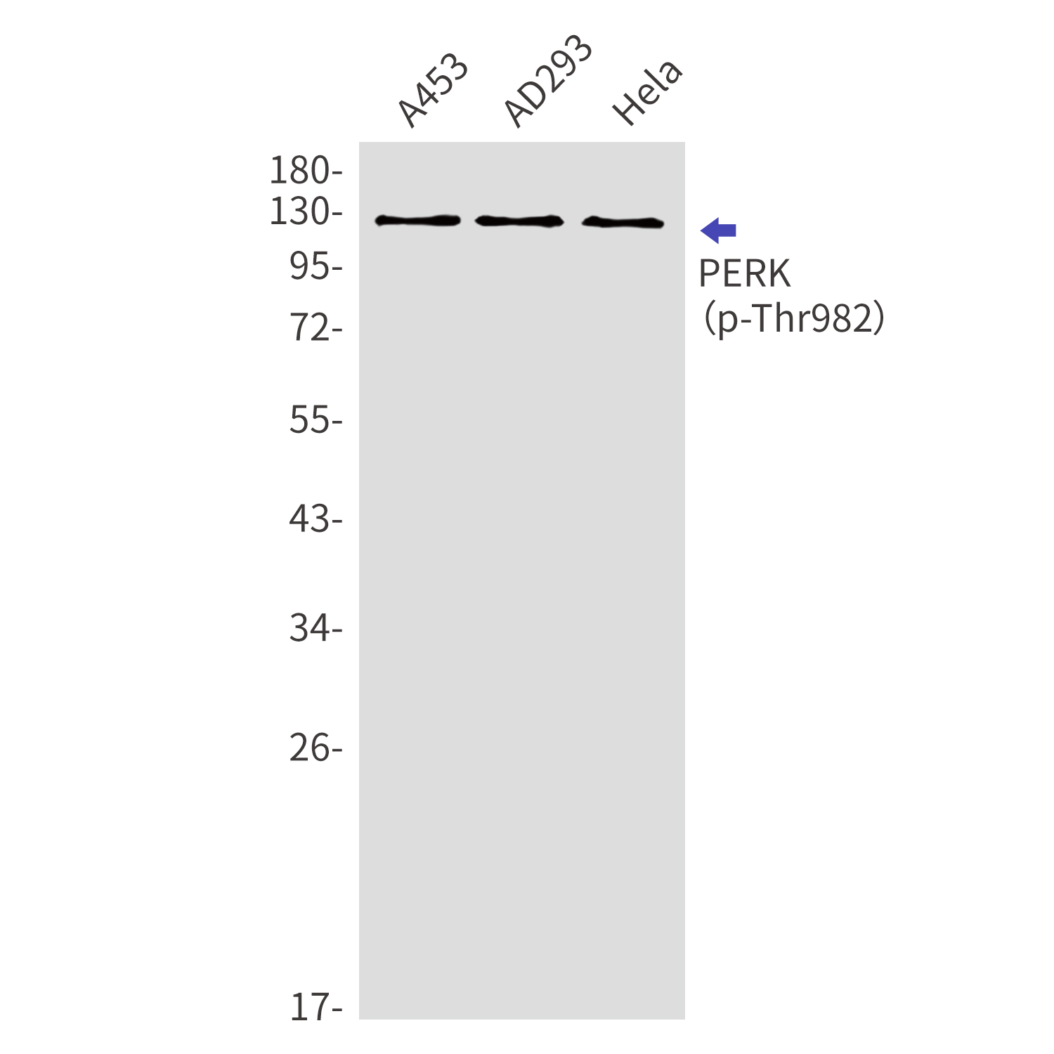 Phospho-PERK (Thr982) Rabbit pAb ABZ4345