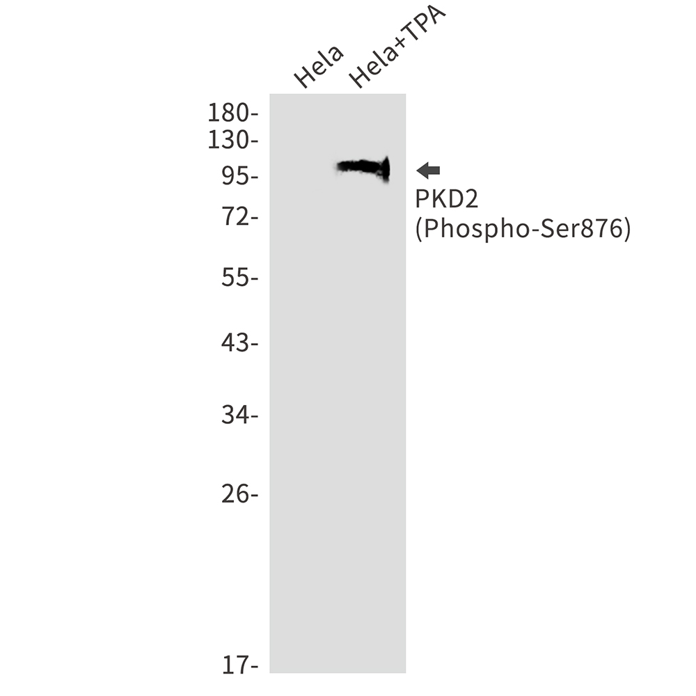 Phospho-PRKD2 (Ser876) Rabbit mAb ABZ4346
