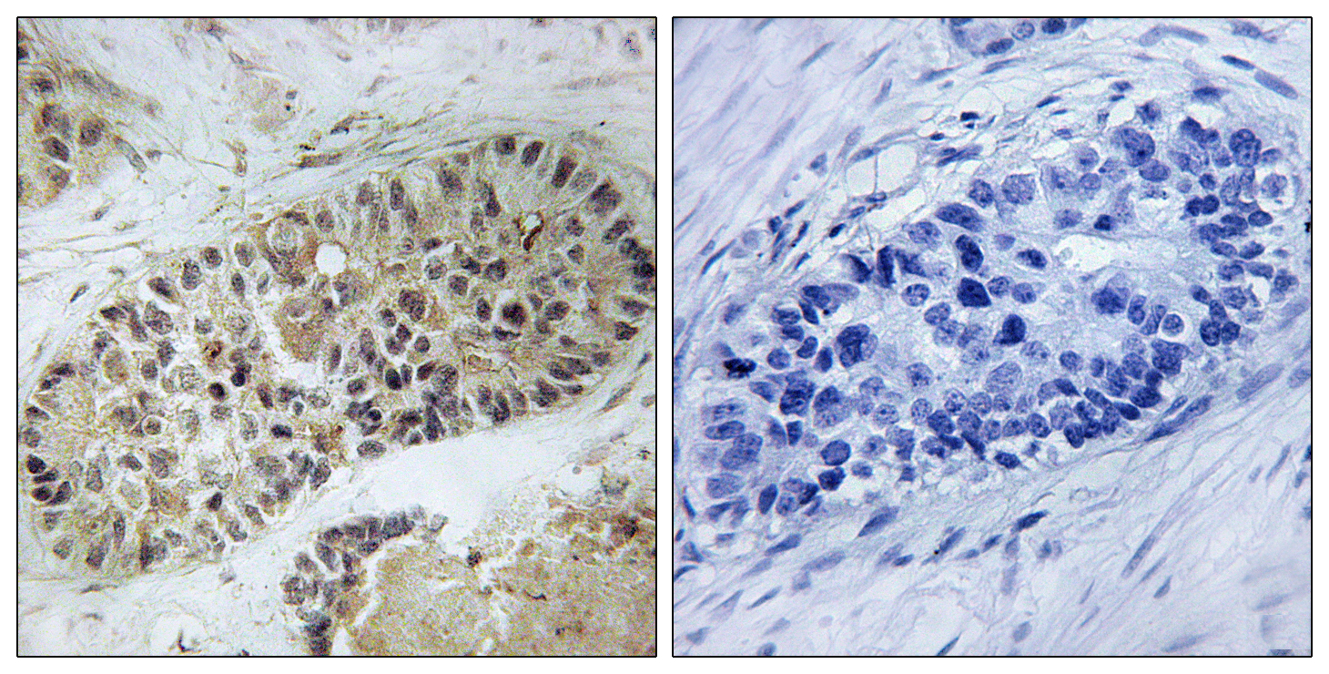 Phospho-Artemis (Ser516) Rabbit pAb ABZ4347