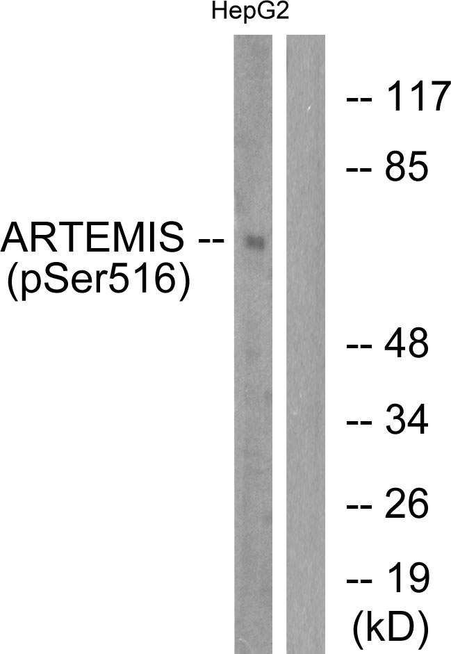 Phospho-Artemis (Ser516) Rabbit pAb ABZ4347