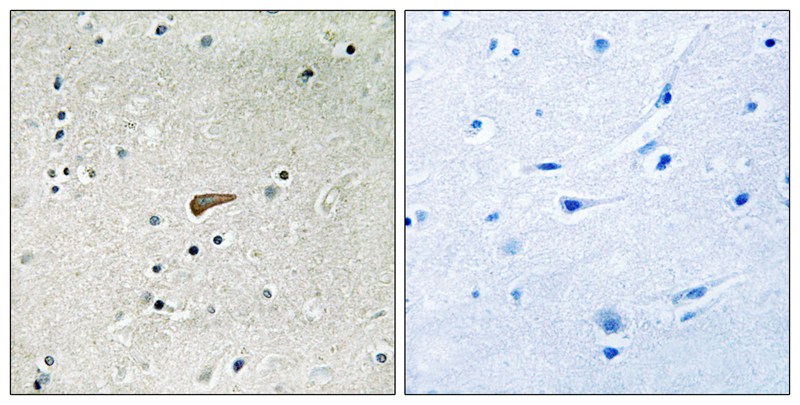 Phospho-FRS2 (Tyr436) Rabbit pAb ABZ4349