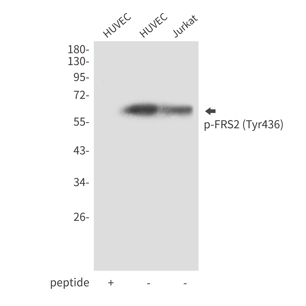Phospho-FRS2 (Tyr436) Rabbit pAb ABZ4349