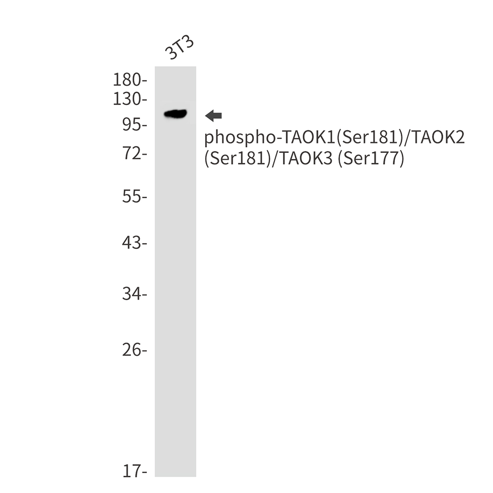 Phospho-TAOK1/2/3 (Ser181/Ser181/Ser177) Rabbit mAb ABZ4350