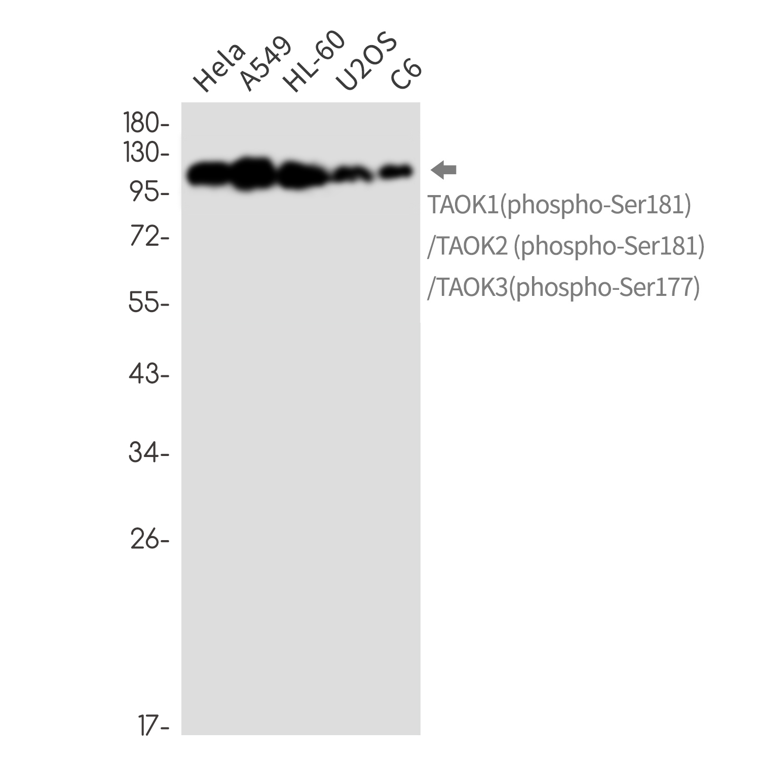 Phospho-TAOK1/2/3 (Ser181/Ser181/Ser177) Rabbit mAb ABZ4350