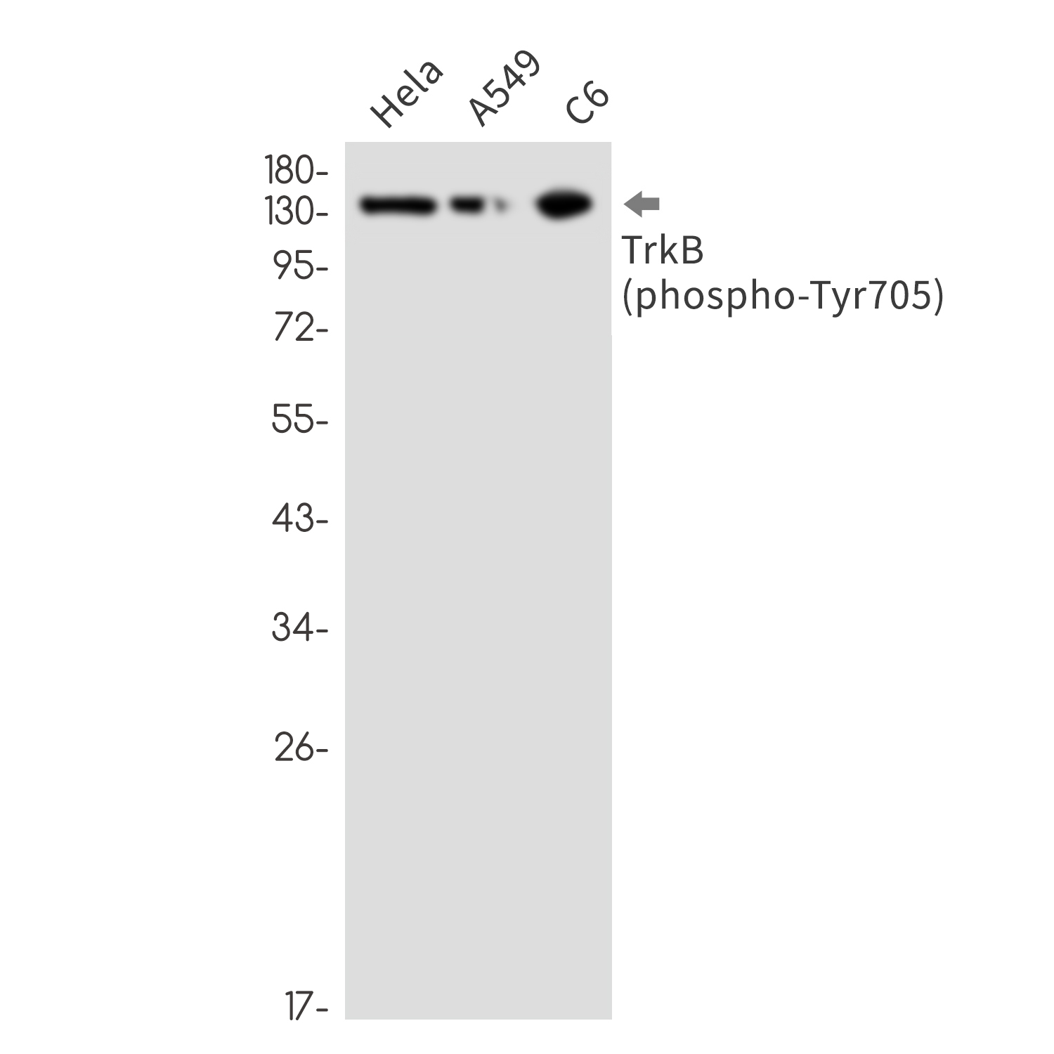 Phospho-TrkB (Tyr705) Rabbit mAb ABZ4351
