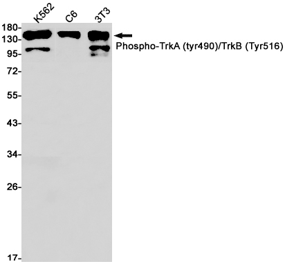 Phospho-TrkA/B (Tyr490/Tyr516) Rabbit mAb ABZ4352