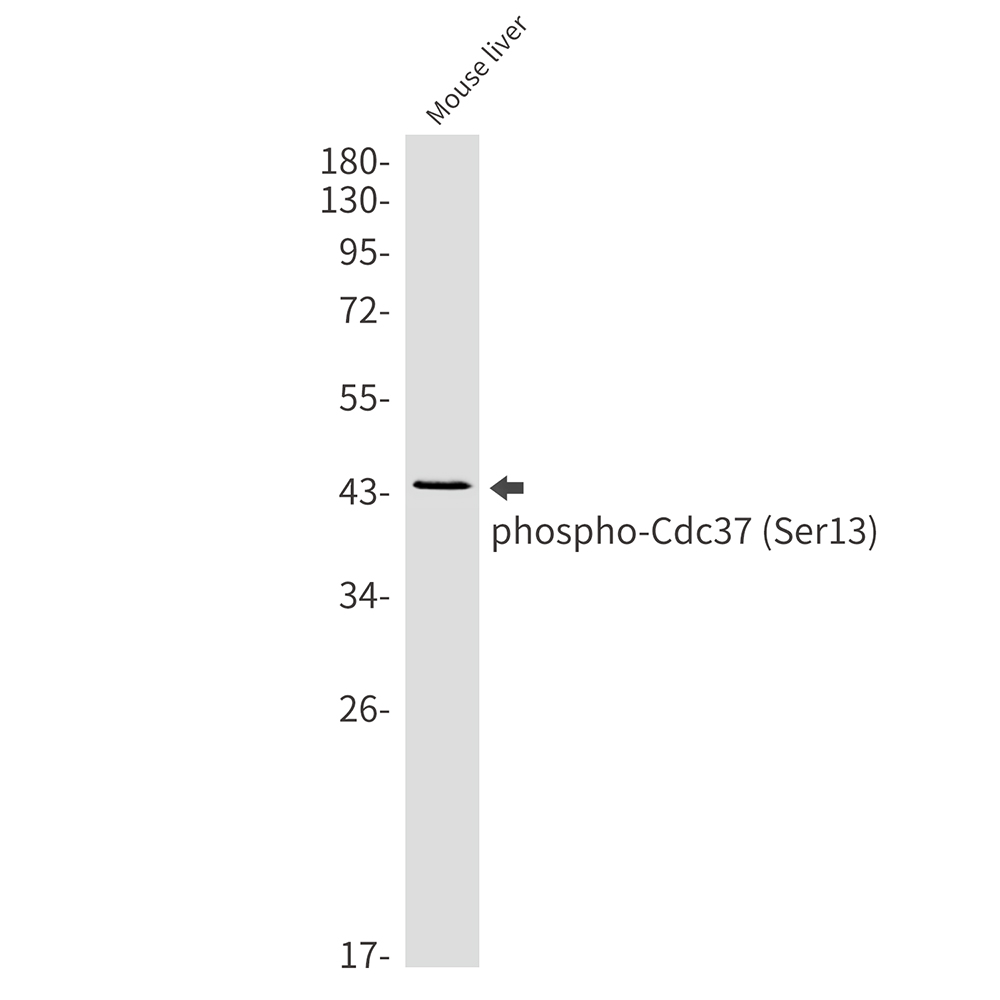 Phospho-CDC37 (Ser13) Rabbit mAb ABZ4353