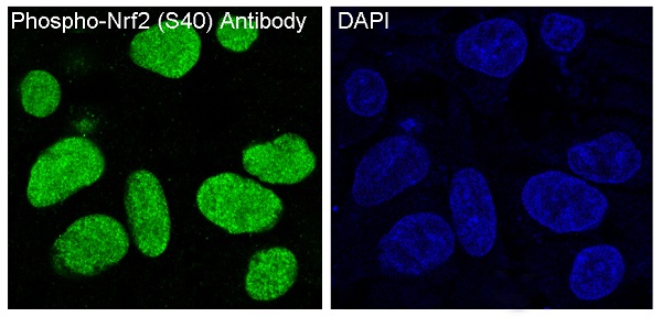 Phospho-NRF2 (Ser40) Rabbit mAb ABZ4356
