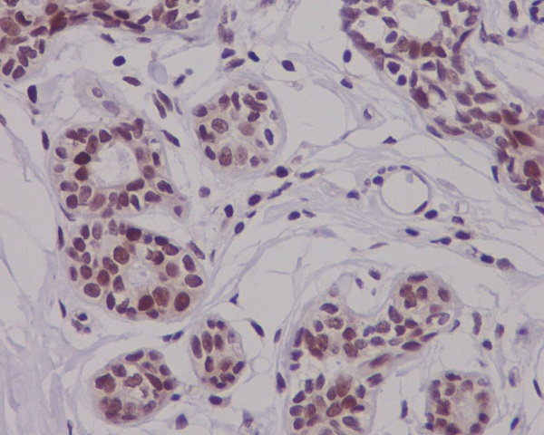 Phospho-NRF2 (Ser40) Rabbit mAb ABZ4356