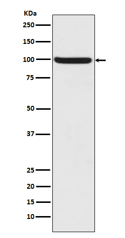 Phospho-NRF2 (Ser40) Rabbit mAb ABZ4356