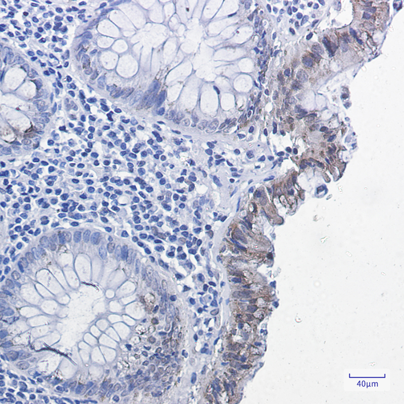 Phospho-Smad2 (Ser255) Rabbit mAb ABZ4358