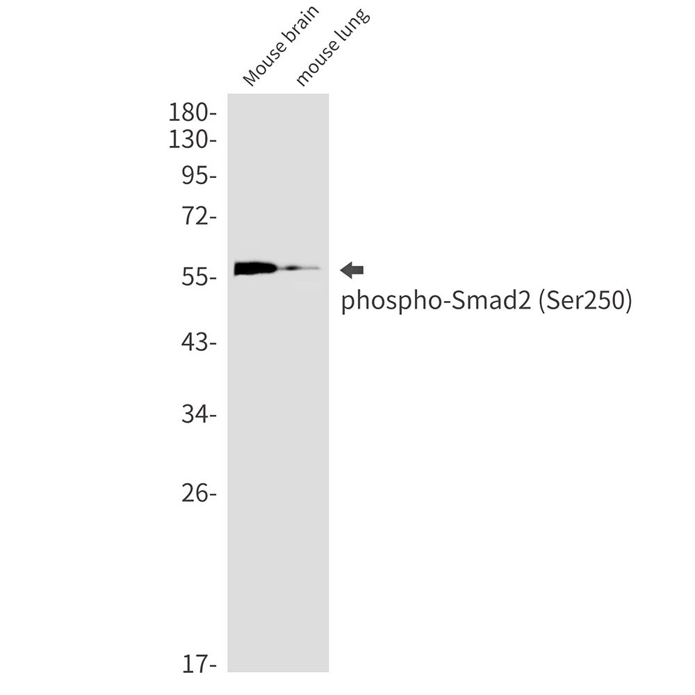 Phospho-Smad2 (Ser250) Rabbit mAb ABZ4359