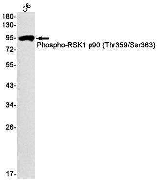 Phospho-RSK1 p90 (Thr359/Ser363) Rabbit mAb ABZ4361