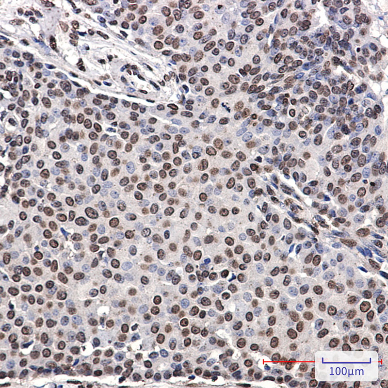 Phospho-ErbB 4 (Tyr1162) Rabbit mAb ABZ4362